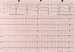 Aktuelles Bild - Abb. 1: Letales EKG