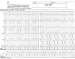 Aktuelles Bild - Abb. 1: EKG - klinische Symptomatik