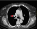 Abb. 7: Thorax-CT