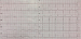 Aktuelles Bild - Abb. 1: EKG - Notaufnahme