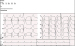 Abb. 1: EKG