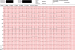 Abb. 1: EKG
