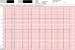 Aktuelles Bild - Abb. 3: EKG