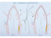 Abb. 21: Arteria femoralis