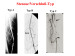 Abb. 23: Stenose/Verschluß-Typ