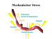 Abb. 44: Stent - Mechanischer Stress