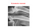 Abb. 45: Stent - Dynamische Anatomie