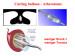 Abb. 57: Cutting balloon - Atherotome