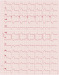 Aktuelles Bild - Abb. 5: EKG