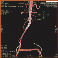 Abbildung 3: Operationssitus
