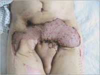 Abbildung 7: Operationssitus