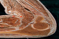 Abbildung 2: Ellbogengelenk