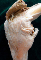 Abbildung 6: Kniegelenk