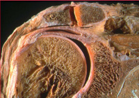 Abbildung 1: Schultergelenk