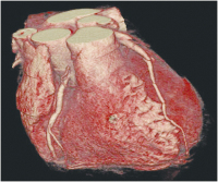 Abbildung 2: Kardiale Computertomographie