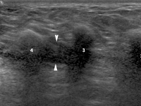 Abbildung 10: Fußsohle