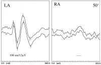 Abbildung 2: Potenziale