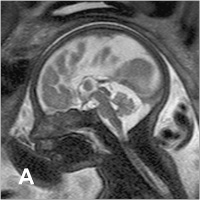 Abbildung 2-a: Fetus - 30. SSW
