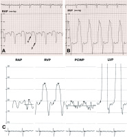 Abbildung 1: PC- Invasive Hämodynamik