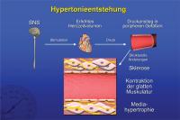 Abbildung 11: Hypertonieentstehung