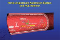 Abbildung 14: Renin-Angiotensin-Aldosteron-System und ACE-Hemmer
