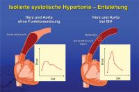Abbildung 5: Isolierte systolische Hypertonie – Entstehung