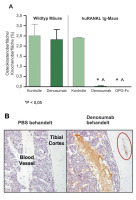 Abbildung 4: Denosumab - Effekt