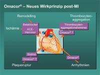 Abbildung 21: Omacor(R) – Neues Wirkprinzip post-MI