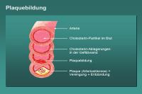 Abbildung 25: Plaquebildung