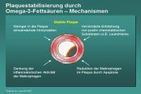 Abbildung 73: Plaquestabilisierung durch Omega-3-Fettsäuren – Mechanismen