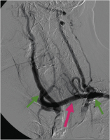 Abbildung 2: Angiographie