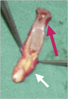 Abbildung 5: Arteria carotis interna