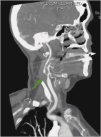 Abbildung 6: CT-Angiographie