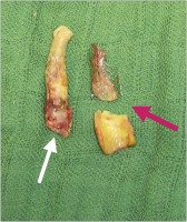 Abbildung 18: Arteria carotis