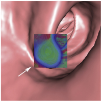 Abbildung 1c: Translucency rendering