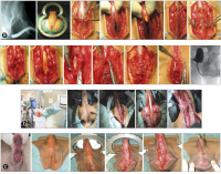 Abbildung 2a-c: Harnröhrenstriktur