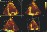Abbildung 4: Apikale Schnitte