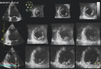 Abbildung 5: 12- Slices-View