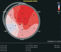 Abbildung 9: Stain-Anaylse
