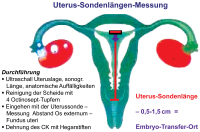 Abbildung 2: Uterus-Sondenlängen-Messung