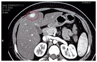 Abbildung 3: CT des Oberbauchs mit Kontrastmittel