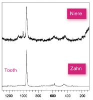 Abbildung 2: Hydroxyapatit