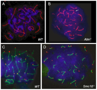 Abbildung 1a-d: Homologous Chromosomes