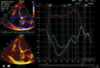 Abbildung 8: Strainanalyse