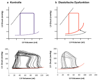 Abbildung 3: Druck-Volumen-Kurve