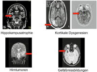 Abbildung 5: Befundung - Epilepsie