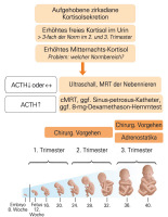 Abbildung 1: Cushing-Syndrom