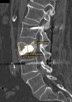 Abbildung 8: LWK III
