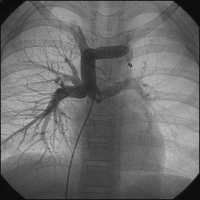 Abbildung 1: Vena cava superior