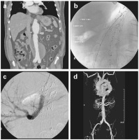 Abbildung 2a-d: Endoprothese